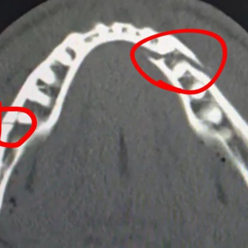 Jake Paul’s Broken Jaw logo